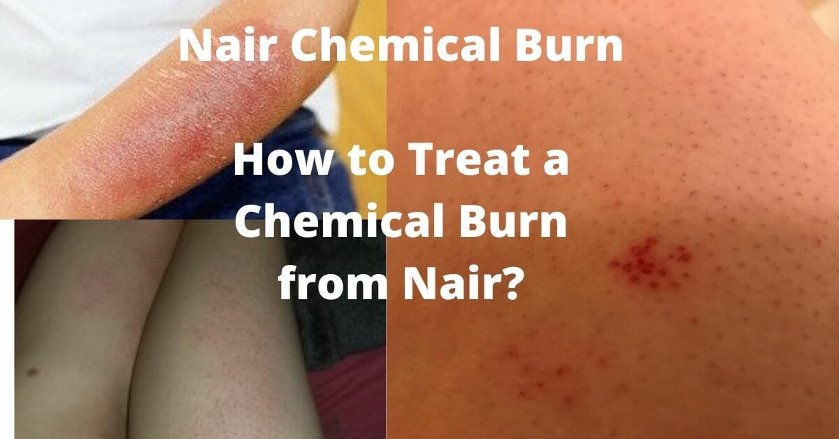 Can You Use Nair On Your Balls? (Safety Guide 2024)