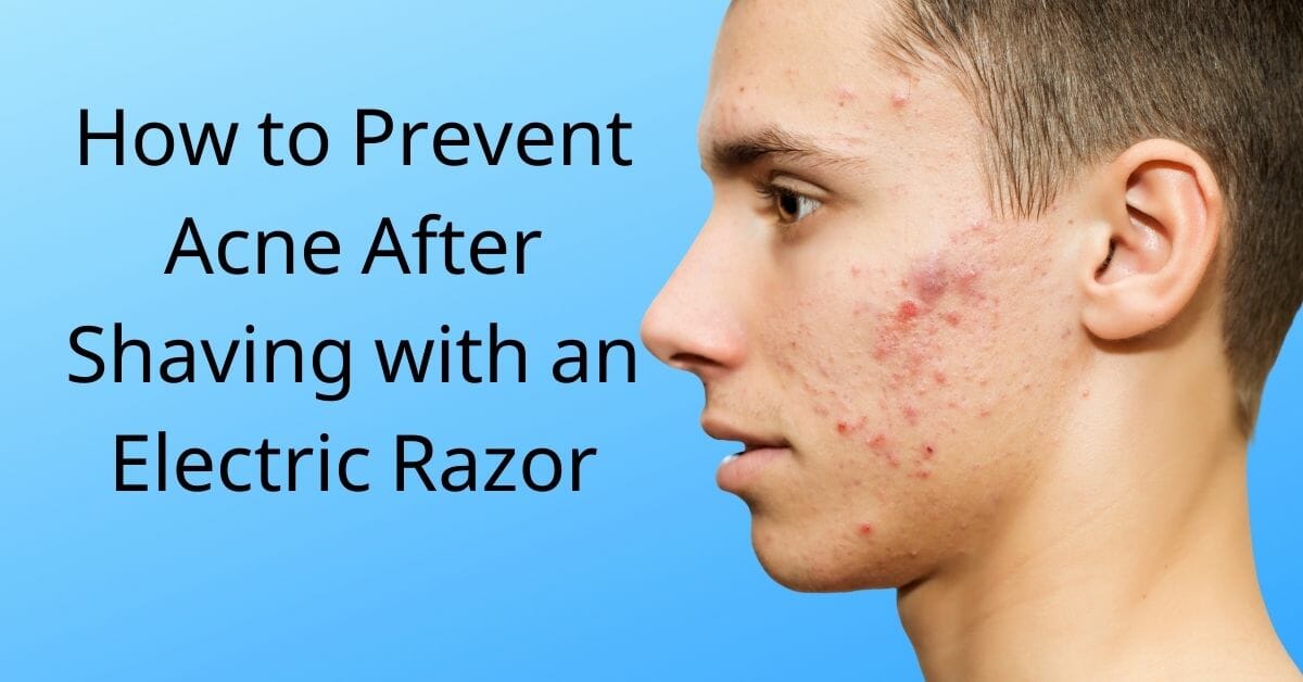 How To Prevent Acne After Shaving With An Electric Razor In 2023