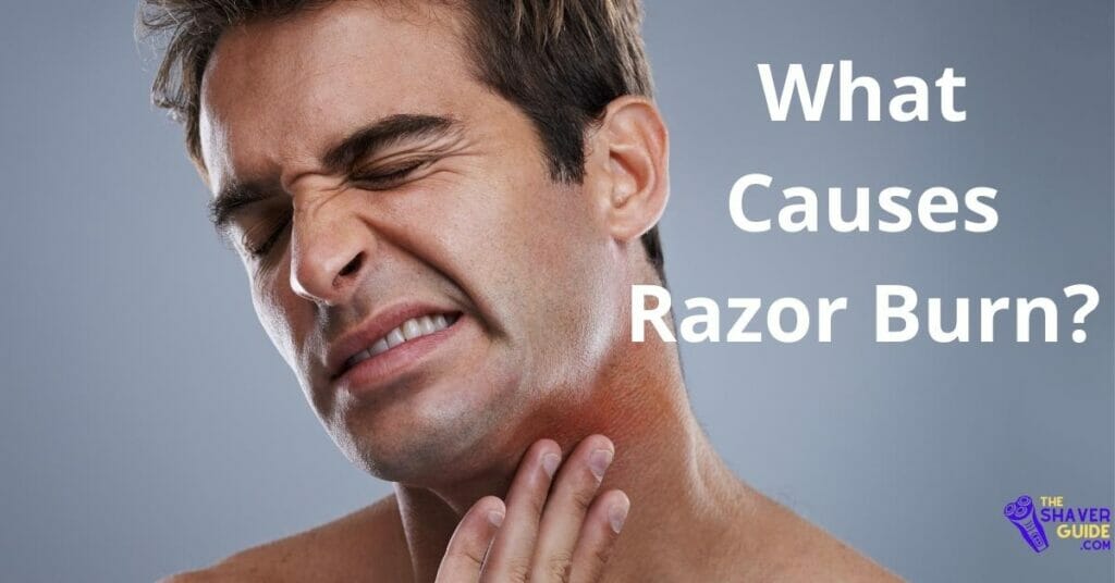 What-Causes-Razor-burn